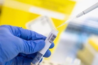 Corona im Vogtland: Landkreis reißt Inzidenz-Grenzwert - Am Dienstag meldete das Landratsamt einen neuen Höchstwert an Infektionen innerhalb von 24 Stunden. Der Inzidenzwert liegt nun bei 50 - dem kritischen Schwellenwert für ein Risikogebiet.