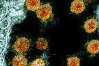 Corona in Chemnitz: Erste Delta-Mutation nachgewiesen - 