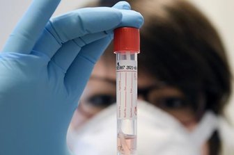 Corona in Chemnitz: Fünf weitere Todesfälle -