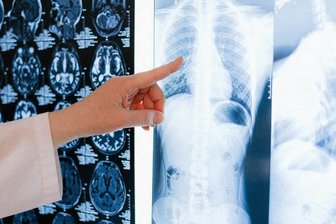 Corona in Sachsen: 156 Kommunen mit Inzidenz über 1000 - 16 Kommunen in Sachsen verzeichnen Inzidenzen über 2000.