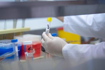 Eine Ärztin zeigt in einem Labor einen Test für das Coronavirus.