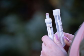 Corona in Sachsen: Über 700 Neuinfektionen, Inzidenzwert im Erzgebirge leicht gesunken -