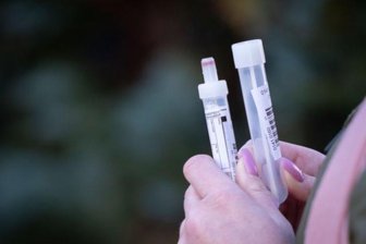Corona in Sachsen: Chemnitz weiter mit niedrigstem Inzidenzwert - In Sachsen sind von Sonntag auf Montag 384 weitere Corona-Fälle nachgewiesen worden.