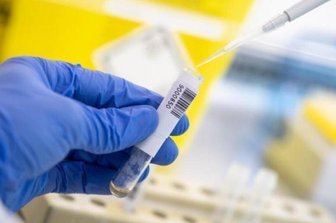 Corona in Sachsen: Jeder zehnte Infizierte liegt im Krankenhaus - Im Freistaat Sachsen sind von Donnerstag auf Freitag 1493 neue Corona-Fälle nachgewiesen worden.