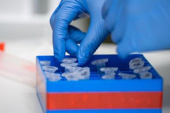 Eine Laborantin führt Untersuchungen zum Coronavirus durch.