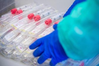 Testsets mit Abstrichstäbchen liegen in einem Testzentrum für Corona-Verdachtsfälle.