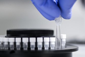 Corona-Inzidenzen in Sachsen: Wert im Vogtlandkreis jetzt bei über 200 - Die Sieben-Tages-Inzidenz in Sachsen ist von Mittwoch auf Donnerstag leicht gestiegen.
