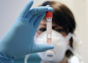 Corona: Kita in Crinitzberg und Schule in Meerane betroffen - Im Landkreis Zwickau haben weitere Neuerkrankungen zu einem erheblichen Anstieg der Quarantäne-Zahlen geführt.