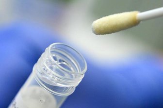            Ein Abstrich für das Testverfahren auf das Coronavirus.