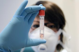 Corona-Lage im Landkreis Zwickau: Das Gesundheitsamt meldet einen weiteren Todesfall - 