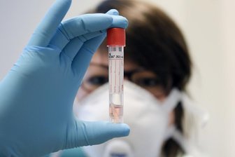 Corona-Lage im Landkreis Zwickau: Infektionen treffen Pflegeheim schwer -