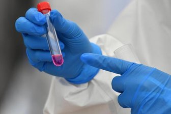 Corona-Lage im Vogtland: Künftig soll es kostenlose Schnelltest für alle geben -