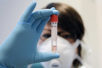 Corona-Lage im Vogtland: Vier weitere Todesfälle - 
