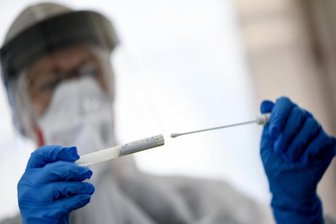 Eine Mitarbeiterin vom Gesundheitsamt hält einen Abstrichstäbchen in der Hand.