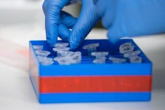 Corona-Lage in Chemnitz: Immer mehr Patienten in Kliniken - Eine Laborantin sortiert Proben.