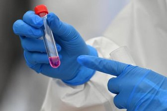 Corona-Lage in Chemnitz: Inzidenz bei 250 -
