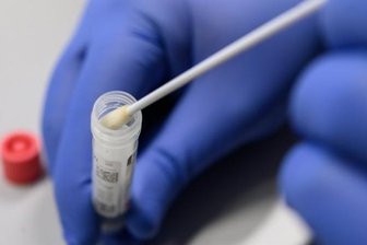Corona-Lage in Chemnitz: Inzidenzwert steigt wieder leicht - Mit 69 neu bestätigten Infektionsfällen pro 100.000 Einwohner innerhalb von sieben Tagen (Stand: Sonntag, 0 Uhr) zeigt sich das Infektionsgeschehen in Chemnitz weiterhin vergleichsweise moderat.