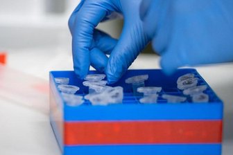Eine Laborantin führt Untersuchungen zum Coronavirus durch.