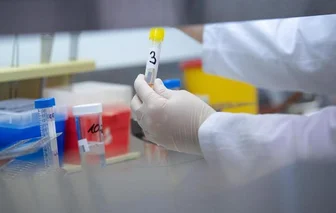            Eine Ärztin zeigt in einem Labor einen Test für das Coronavirus.