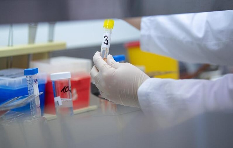            Eine Ärztin zeigt in einem Labor einen Test für das Coronavirus.