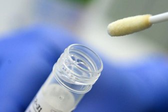 Ein Abstrich für das Testverfahren auf das Coronavirus.