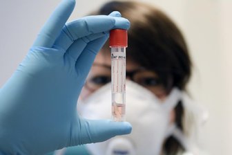 Corona: Landratsamt meldet Neuinfektion -