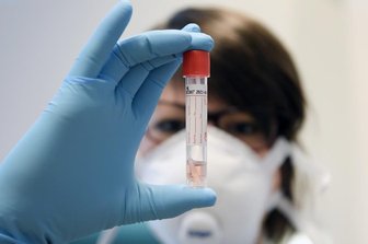 Corona-Virus: 20 neue Fälle in Mittelsachsen -