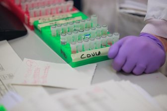 Corona-Virus: Am Donnerstag vier neue Fälle in Annaberg gemeldet -