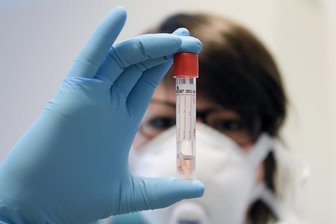 Corona-Virus: Die Lage im Erzgebirge am Donnerstag - 