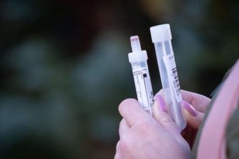 Corona: Weitere Testergebnisse für Mittwoch erwartet - Am Dienstag gab es keine weiteren bestätigten Corona-Fälle im Landkreis Mittelsachsen, teilte die Behörde mit.
