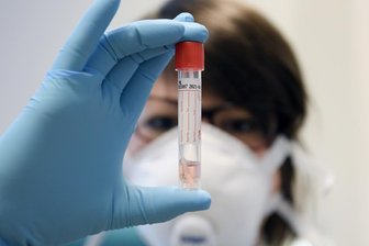 Corona: Zahl der Infizierten steigt auf 127 -
