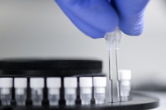 Corona: Zwei weitere Todesfälle nach Infektion -