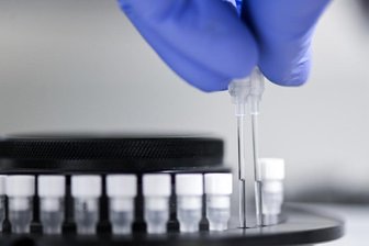 Coronakrise: Zwei weitere Tote in Sachsen und 36 Neuinfektionen -