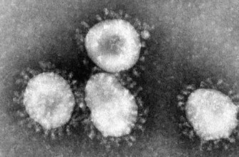 Coronaviren: DAK in Plauen schaltet Info-Hotline - So sieht ein Coronavirus unter dem Mikroskop aus.