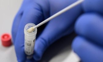 Coronavirus: 769 Infektionen im Landkreis Zwickau - Die Anzahl der nachgewiesenen Corona-Infektionen im Landkreis Zwickau ist bis Samstagvormittag auf 769 angestiegen.