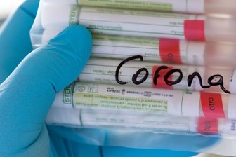 Coronavirus - Die Lage im Erzgebirge am Dienstag - 