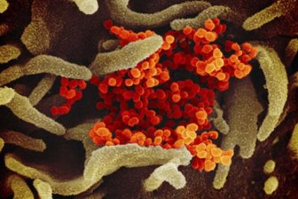 Coronavirus: Die Lage im Erzgebirge am Mittwoch - 