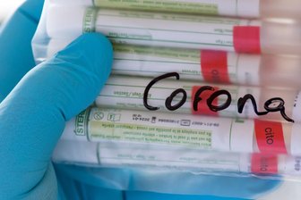 Coronavirus - Die Lage im Erzgebirge am Montag -