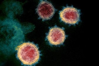           Elektronenmikroskopische Aufnahme zeigt das Virus, das COVID-19 verursacht.