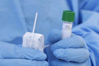 Coronavirus: Die Lage in Chemnitz am Dienstag - 