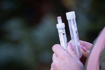 Coronavirus: Die Lage in Chemnitz - Eine Frau hält Teströhrchen für einen Abstrichtest und eine Blutprobe in den Händen (Symbolbild).