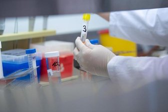 Coronavirus: Erste Infektion in Sachsen bestätigt -