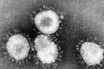 Coronavirus-Fall in Hofer Kita - In einer Hofer Kindertagesstätte ist eine Person positiv auf SARS-CoV-2 getestet worden.
