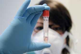 Coronavirus in Sachsen: Weiterer Todesfall -