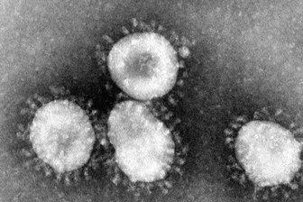 Coronavirus unter dem Mikroskop.