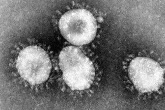 Coronavirus: Jetzt 13 Todesfälle im Landkreis Zwickau - Im Landkreis Zwickau sind von Montag auf Dienstag drei weitere Menschen verstorben, die sich zuvor mit dem Coronavirus infiziert hatten.