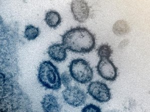 Coronavirus: Mehr als 4000 nachgewiesene Infektionen und 87 Tote in Sachsen - Elektronenmikroskopische Aufnahme zeigt das neuartige Coronavirus SARS-CoV-2.