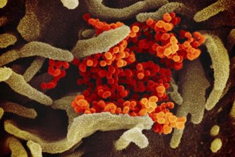 Coronavirus: Zahl der Infizierten im Landkreis Zwickau kaum gestiegen - Die Zahl der nachgewiesenen Corona-Fälle im Landkreis Zwickau ist von Donnerstag auf Freitag nur um einen auf 764 angestiegen.