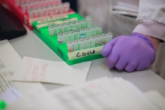 Coronavirus: Zahl der Todesfälle im Kreis Zwickau steigt auf 28 - Die Zahl der verstorbenen Covid-19-Erkrankten im Landkreis Zwickau ist von Dienstag auf Mittwoch um zwei auf 28 gestiegen.