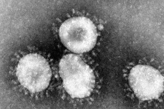 Coronavirus: Zahl der Todesfälle im Landkreis Zwickau steigt auf 24 - Die Zahl der im Landkreis Zwickau verstorbenen Covid-19-Patienten ist von Samstag auf Montag um zwei auf 22 gestiegen.